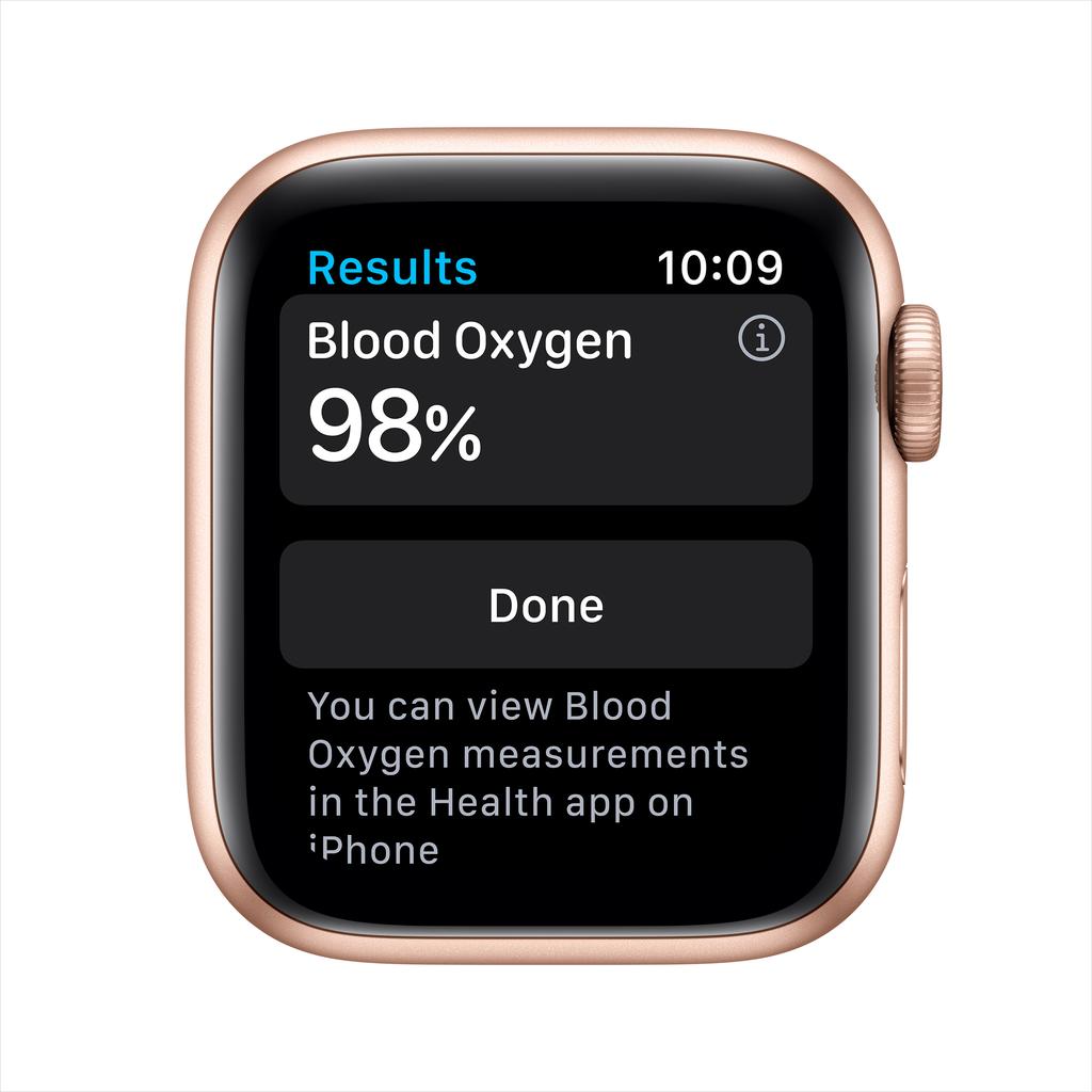 Apple Watch SE Series 1 (2020) - (bracelet non inclus) - GPS 40 mm - Or Aluminium Reconditionné - 159,00 € Apple Watch SE Series 1 (2020) - (bracelet non inclus) - GPS 40 mm - Or Aluminium Reconditionné Apple reconditionné disponible sur Backmarket