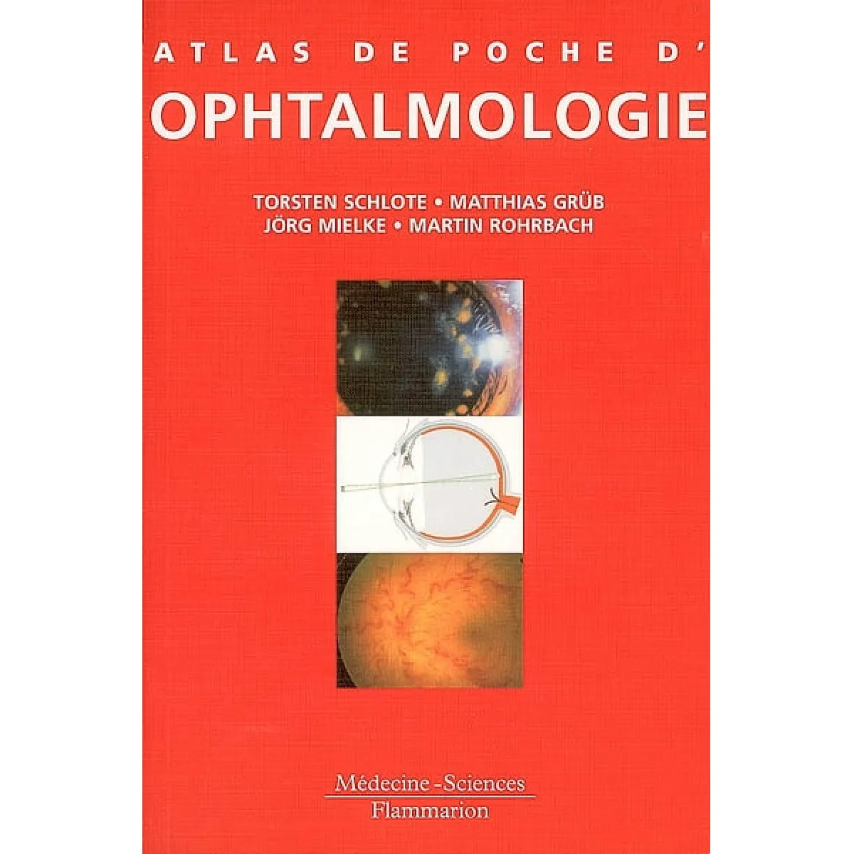 Acheter Atlas de poche d'ophtalmologie État correct - 16,71 € Atlas de poche d'ophtalmologie État correct N/A (Il ne s'agit pas d'une marque reconditionné disponible sur Rue du Commerce Seconde Vie