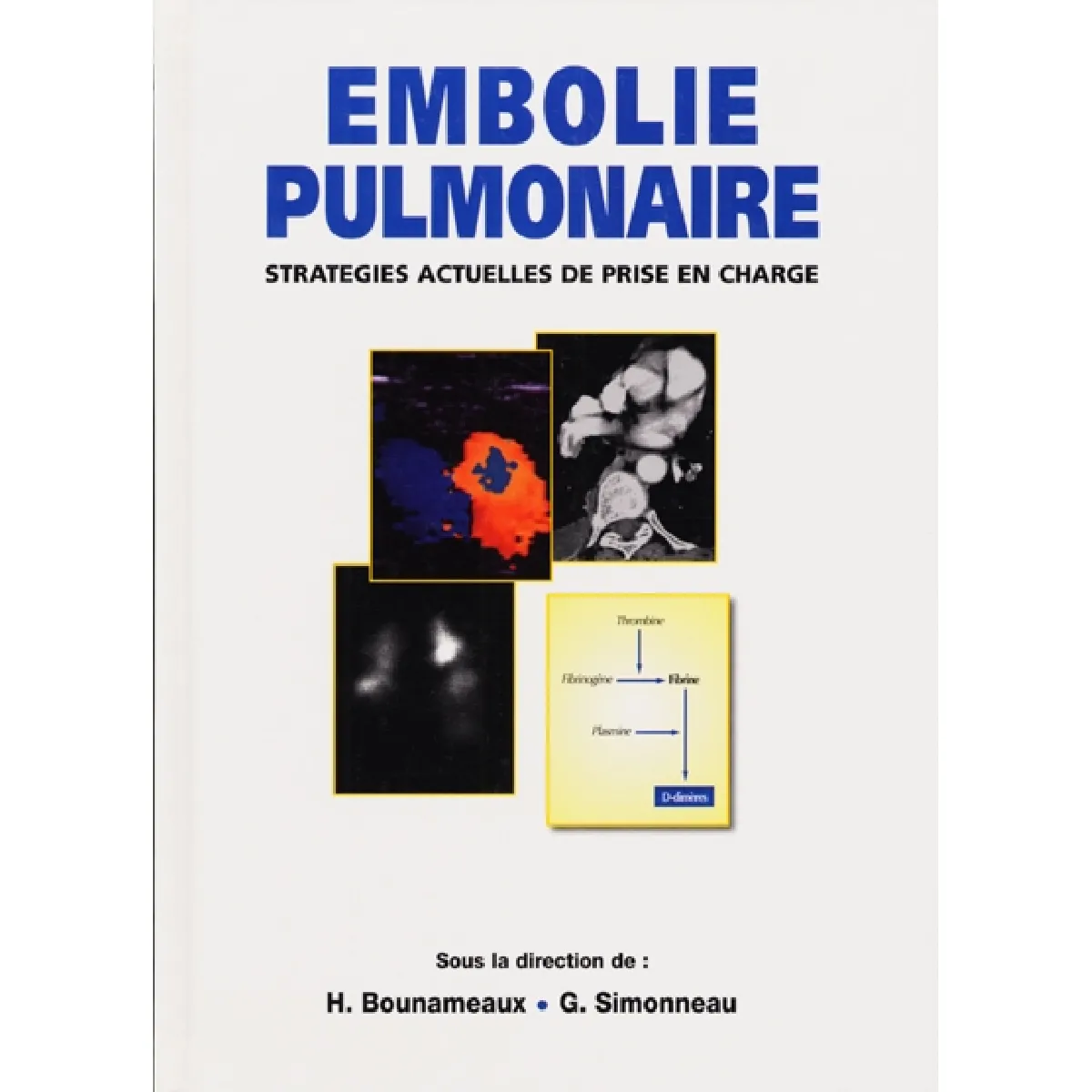 Acheter Embolie pulmonaire : stratégies actuelles de prise en charge État correct - 16,00 € Embolie pulmonaire : stratégies actuelles de prise en charge État correct N/A (Il ne s'agit pas d'une marque reconditionné disponible sur Rue du Commerce Seconde Vie