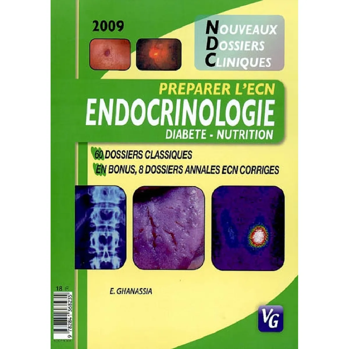 Acheter Endocrinologie, diabète, nutrition : 60 dossiers classiques, 8 dossiers annales ECN corrigés : préparer l'ECN 2009 État correct - 29,00 € Endocrinologie, diabète, nutrition : 60 dossiers classiques, 8 dossiers annales ECN corrigés : préparer l'ECN 2009 État correct N/A (Il ne s'agit pas d'une marque reconditionné disponible sur Rue du Commerce Seconde Vie