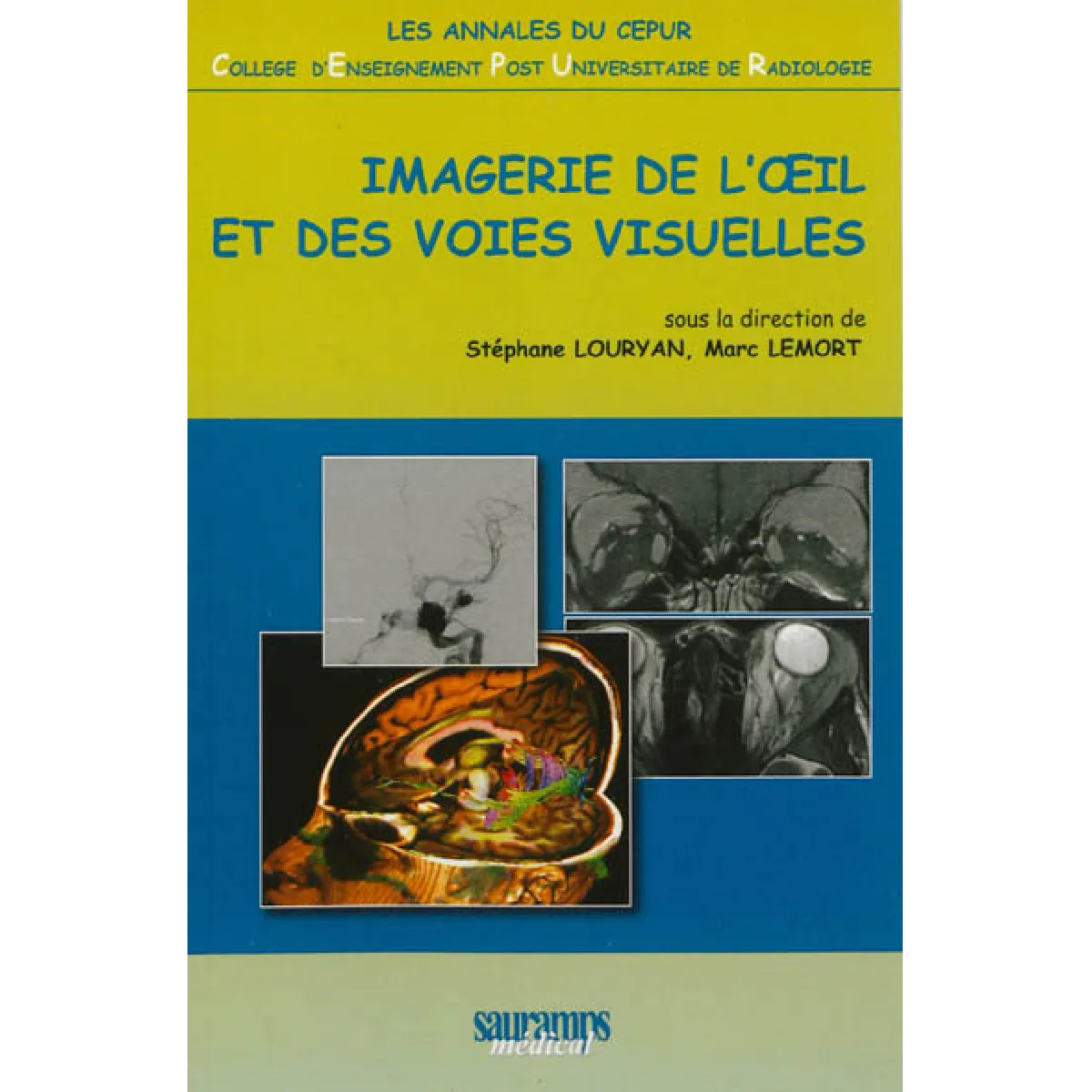 Acheter Imagerie de l'oeil et des voies visuelles État correct - 17,09 € Imagerie de l'oeil et des voies visuelles État correct N/A (Il ne s'agit pas d'une marque reconditionné disponible sur Rue du Commerce Seconde Vie