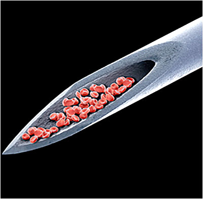 Live blood État correct - 113,99 € Live blood État correct reconditionné disponible sur Fnac | Dero
