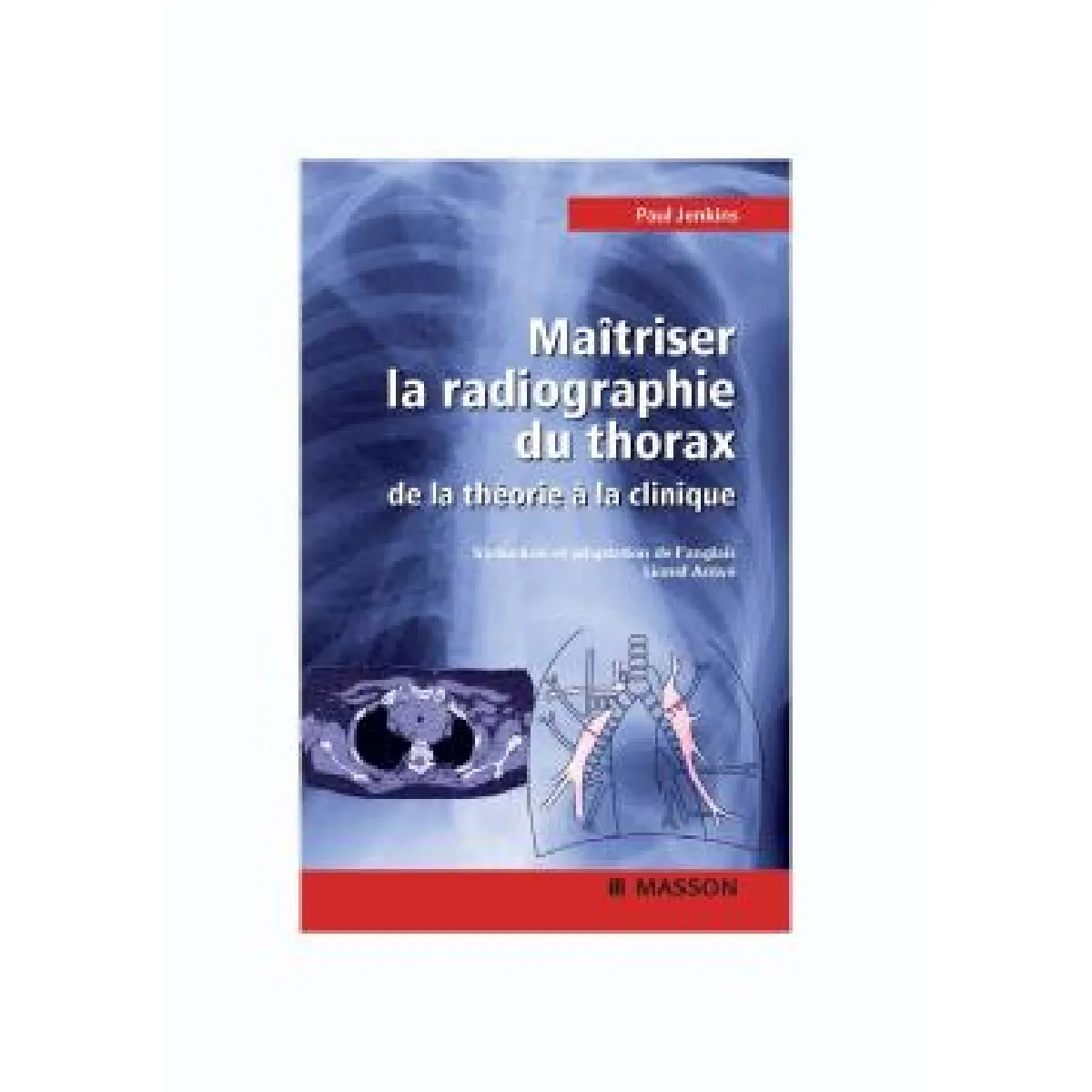 Acheter Maîtriser la radiographie du thorax : guide pratique État correct - 22,81 € Maîtriser la radiographie du thorax : guide pratique État correct N/A (Il ne s'agit pas d'une marque reconditionné disponible sur Rue du Commerce Seconde Vie