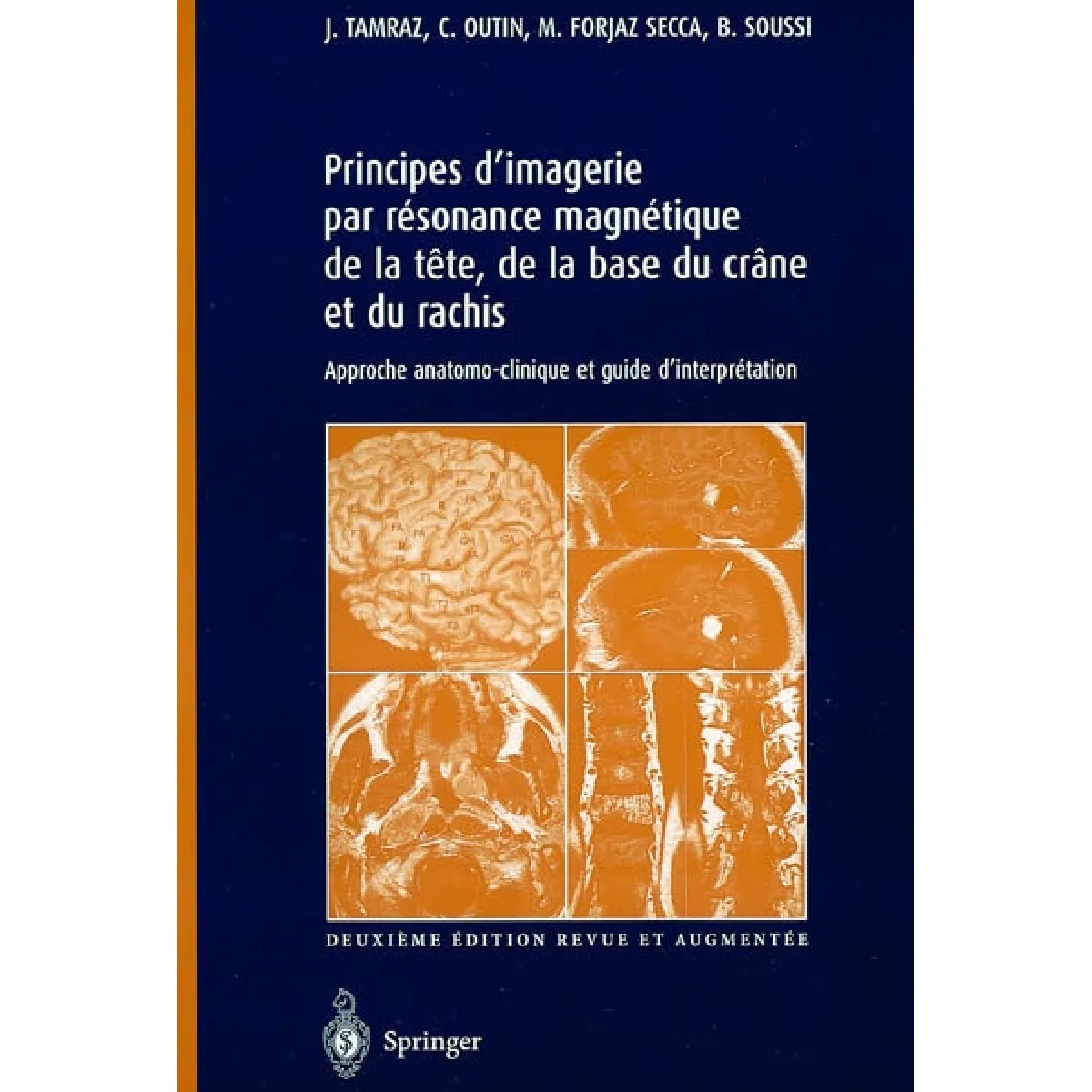 Acheter Principes d'imagerie par résonance magnétique de la tête, de la base du crâne et du rachis : approche anatomo-clinique et guide d'interprétation État correct - 16,51 € Principes d'imagerie par résonance magnétique de la tête, de la base du crâne et du rachis : approche anatomo-clinique et guide d'interprétation État correct N/A (Il ne s'agit pas d'une marque reconditionné disponible sur Rue du Commerce Seconde Vie