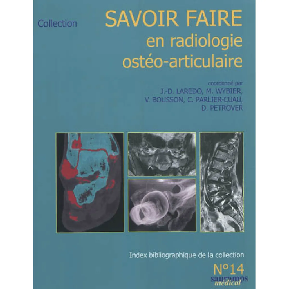 Acheter Savoir faire en radiologie ostéo-articulaire. Vol. 14 État correct - 12,53 € Savoir faire en radiologie ostéo-articulaire. Vol. 14 État correct N/A (Il ne s'agit pas d'une marque reconditionné disponible sur Rue du Commerce Seconde Vie