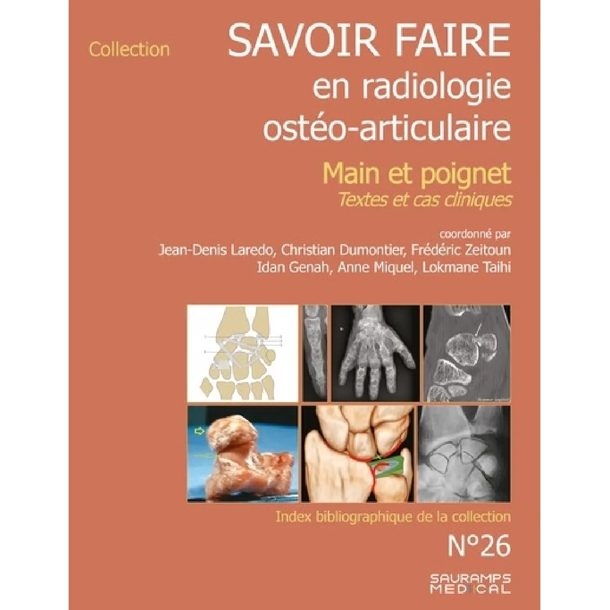 Acheter Savoir faire en radiologie ostéo-articulaire. Vol. 26. Main et poignet : textes et cas cliniques État correct - 18,67 € Savoir faire en radiologie ostéo-articulaire. Vol. 26. Main et poignet : textes et cas cliniques État correct N/A (Il ne s'agit pas d'une marque reconditionné disponible sur Rue du Commerce Seconde Vie